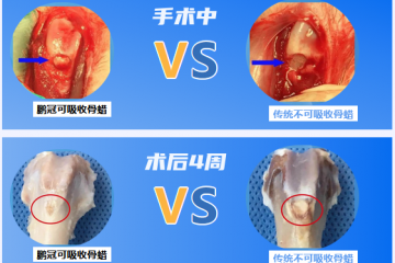 國內零突破，直擊770 萬臺骨科手術剛需